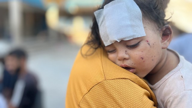 Article thumbnail: NUSAIRAT, GAZA - JULY 16: Sister of Palestinian little girl Zeyna El Karnawi (not seen), endures brutal conditions along with her family which was attacked at the school of UNRWA by Israeli forces while sheltering with other displaced Palestinians in Nusairat Refugee Camp, Gaza on July 16, 2024. (Photo by Salama Nabeel Eaid Younes/Anadolu via Getty Images)